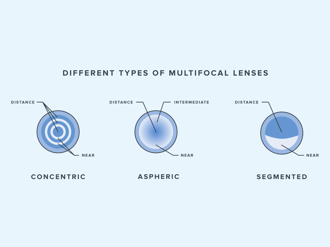 Diagram illustrating the difference between the three types of multifocal lenses