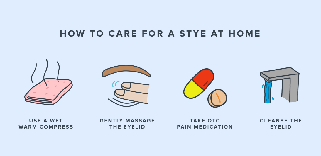 Infographic showing how to care for a stye at home