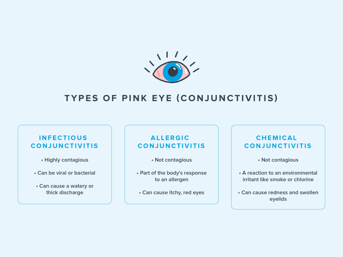 Infographic comparing three types of pink eye