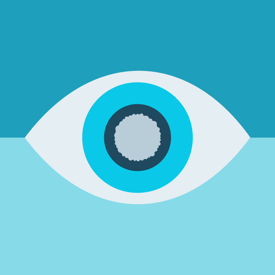 graphic of an eye with glaucoma