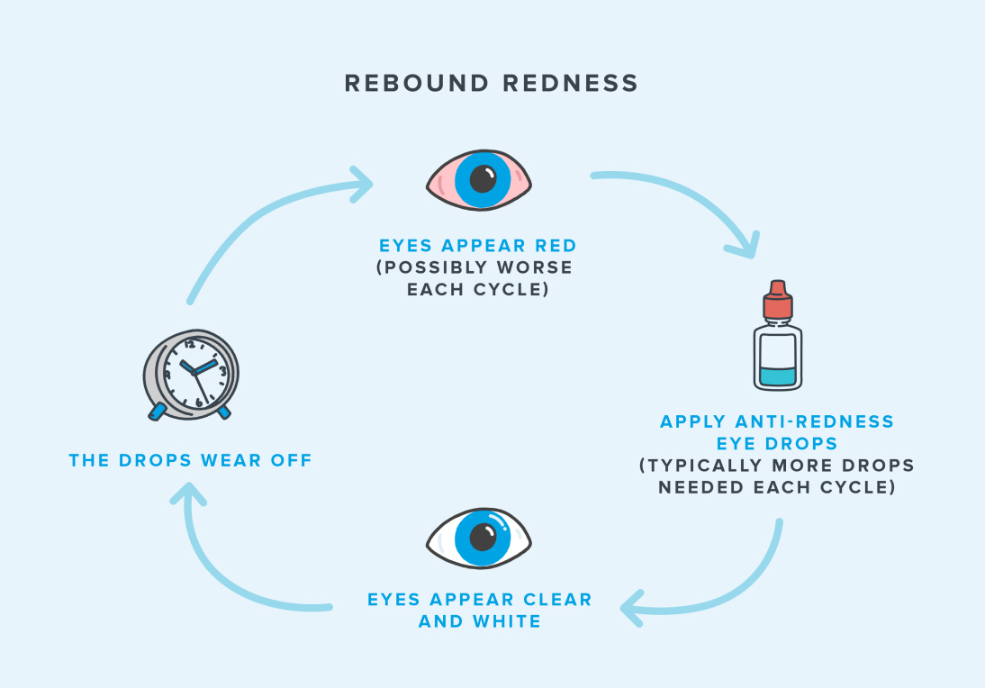 Eye drops for red eyes relief cycle.