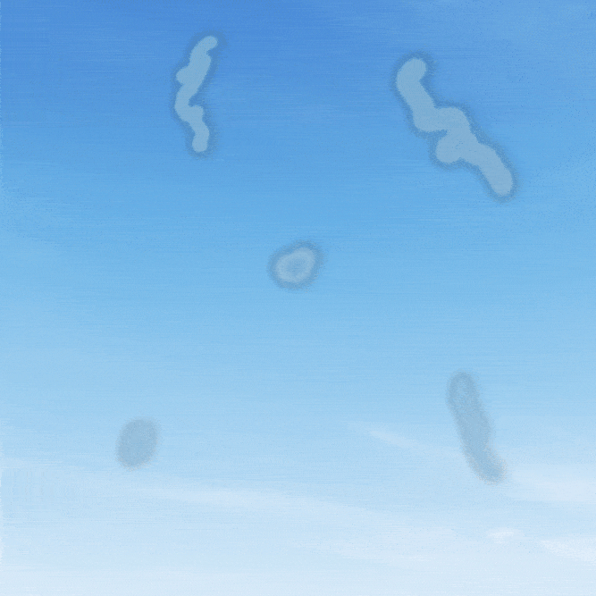 Animated GIF of diffuse eye floater