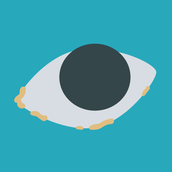 illustration of an eye with discharge