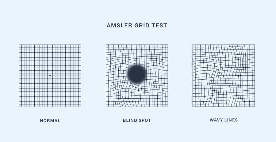 Amsler grid test for AMD.