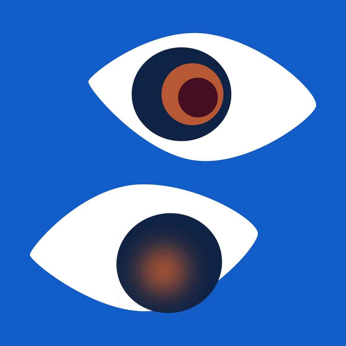 Wet AMD vs. dry AMD