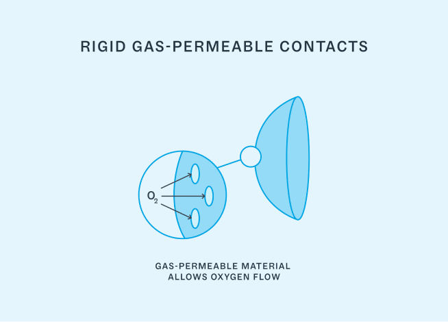 Image of oxygen passing through rigid gas permeable contacts
